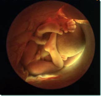 31 недель 6 дней. Малыш в утробе 32 неделе беременности. Ребёнок в 34 недели беременности в утробе. Малыш в утробе 31 неделя. 32 Недели беременности фото плода.